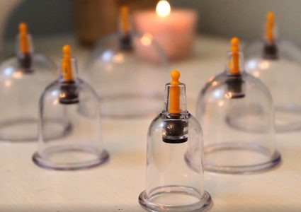 الحجامة .. فوائدها ومن هم الأشخاص الذين يجب أن يتجنبوها ؟!