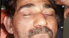 التعرف على هوية شخص عُثر عليه فاقداً للوعي