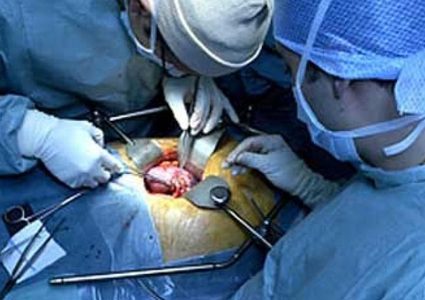 "وهب الأعضاء" حياة تنقذ المرضى الثكالى