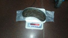 استخراج 639 مسمارا من أمعاء رجل
