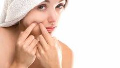 أطعمة تسبب حَبّ الشباب تجنبوها