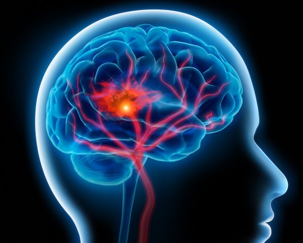 علماء يطورون علاجا للأمراض الدماغية المستعصية