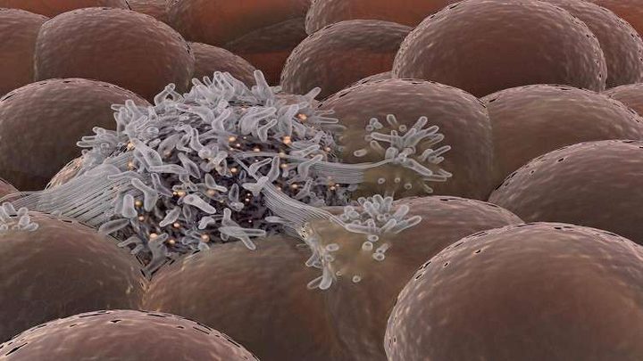 "الكأس المقدسة" لمحاربة السرطان