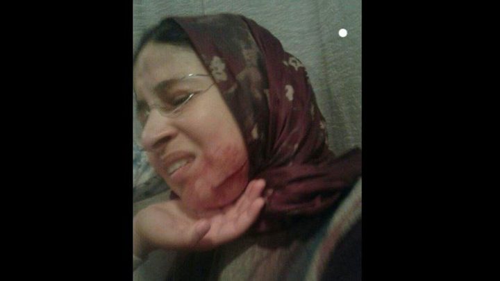 بالصور: تلميذ يشوه وجه معلمته بالسكين