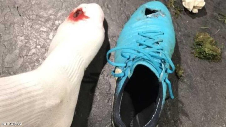 مدافع تشلسي يفضح "رداءة" حذائه