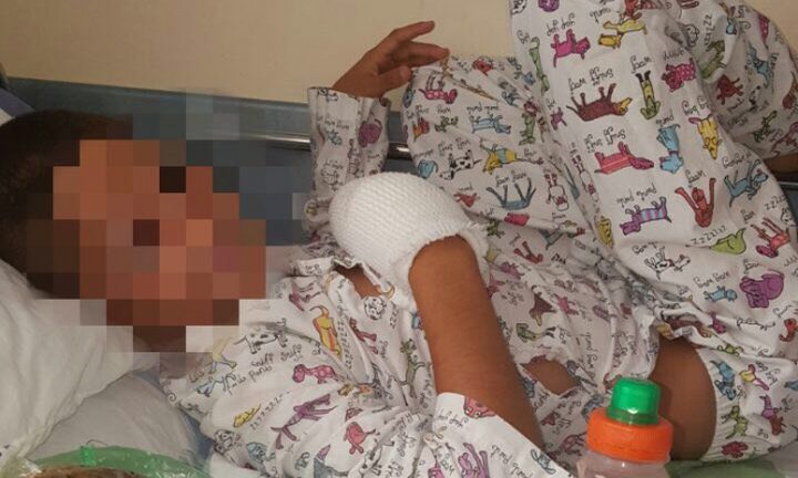 إصابة طفل بجروح بليغة جراء انفجار ألعاب نارية