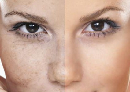 لكِ سيدتي..نصائح لبشرة ناعمة ورطبة بالشتاء