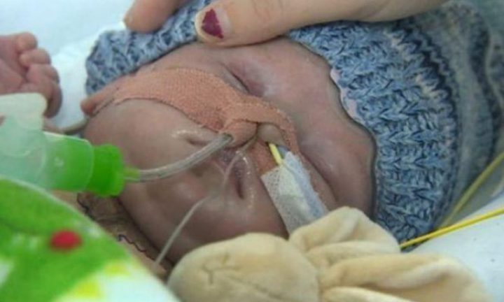 نجاح زراعة قلب لرضيع عمره 8 أسابيع