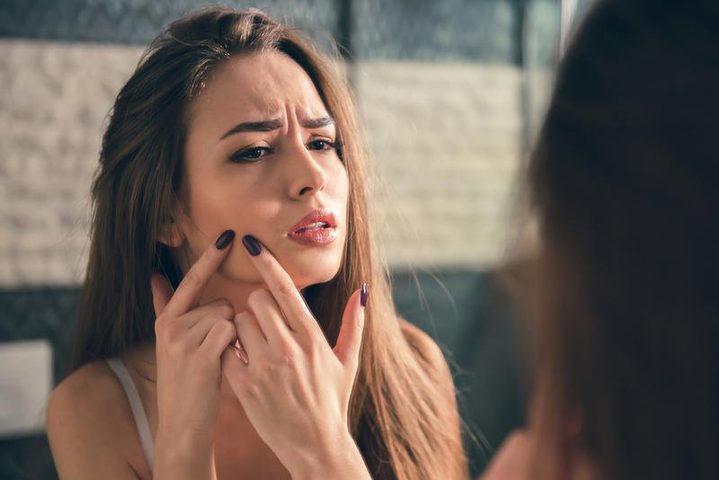 أطعمة تسبب حب الشباب... تجنبيها