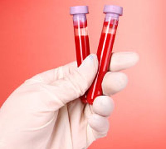 فحص الدم يساهم في علاج السرطان