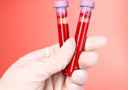 فحص الدم يساهم في علاج السرطان