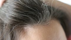 كل ما تحتاجون معرفته عن الشعر الابيض المبكر