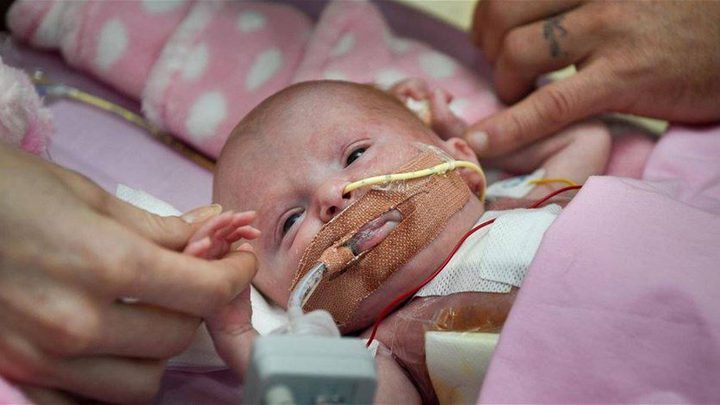 ولادة رضيعة بقلبٍ خارج جسدها... فهل نجح الأطباء في إنقاذها؟