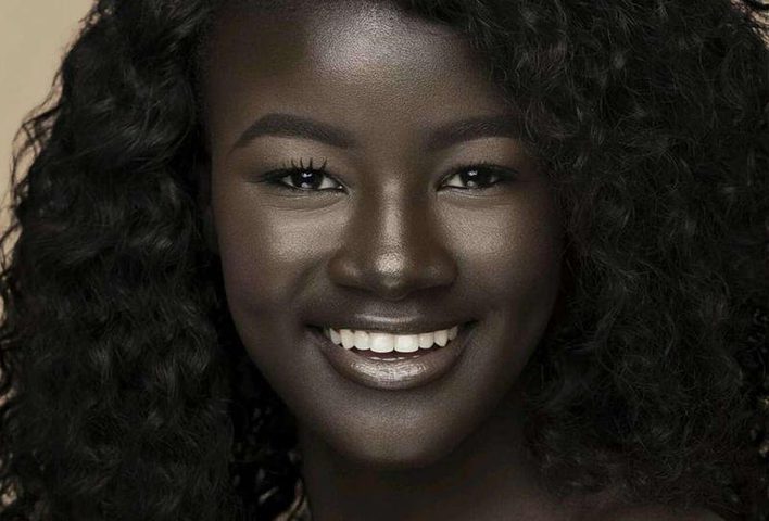 قصص وصور لأشخاص يملكون لون بشرة غريبة