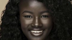 قصص وصور لأشخاص يملكون لون بشرة غريبة