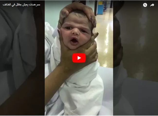 ممرضات "يعذِّبن"رضيعاً (فيديو صادم)