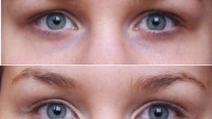 القرفة للتخلص من الجيوب المنتفخة تحت العينين