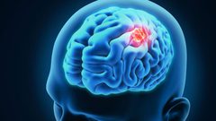 انتقادات لشركة رفعت ثمن دواء للسرطان