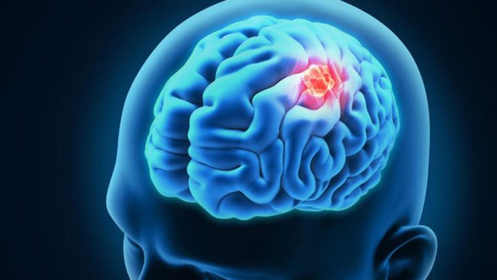 انتقادات لشركة رفعت ثمن دواء للسرطان