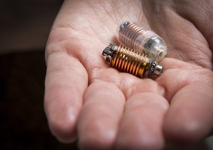 حبوب إلكترونية لتنظيم عمل الأمعاء