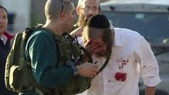 إصابة طفيفة لمستوطن جراء انقلاب مركبته قرب حزما
