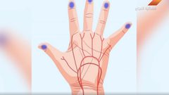 أضرار فرقعة أصابعك (فيديو)