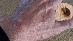 120 لسعة لمسافر على درجة رجال الأعمال