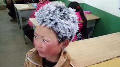 خبر سعيد للطالب ذي الشعر المتجمد