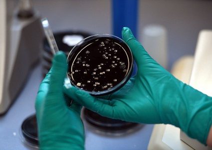 هل هناك علاقة بين السوبر بكتيريا بالسباحة؟