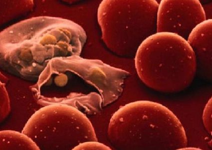 إكتشاف جديد.. معجون الأسنان سلاح لمكافحة هذا المرض