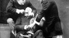 كيف كان طب الأسنان في العصور القديمة؟