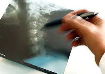 الأسماك مفتاح علاج الشلل لدى البشر