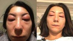 أرادت أن تطيل رموشها فحجبت الرؤية عن عينيها!