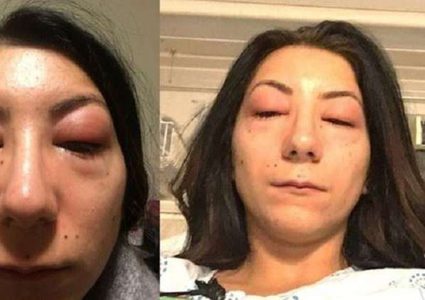 أرادت أن تطيل رموشها فحجبت الرؤية عن عينيها!