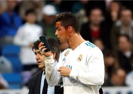 إصابة دامية لكريستيانو رونالدو