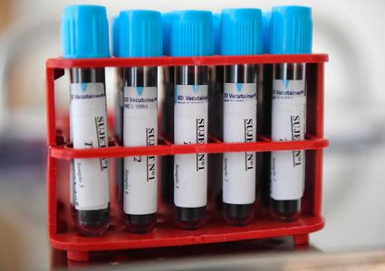 تقدم كبير يحرزه العلماء في الكشف عن السرطان