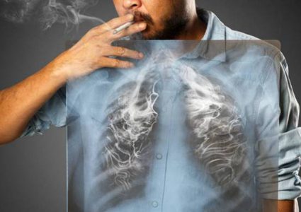 هكذا تنظف رئتيك من النيكوتين