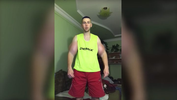 صاحب الذراعين الملقبتين بـ "قذيفتي البازوكا"يعود من جديد