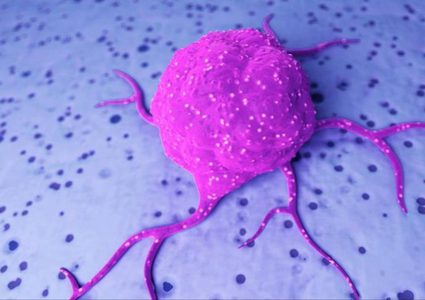 الأطعمة المسببة للالتهاب قد تؤدي لسرطان القولون