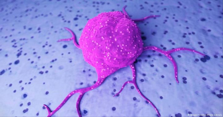 الأطعمة المسببة للالتهاب قد تؤدي لسرطان القولون