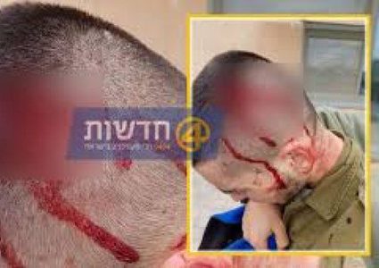 في شجار ...إصابة 11 جنديًا إسرائيليًا