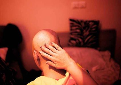 جدل بشأن أهمية العلاج الكيماوي لمرضى السرطان الثدي