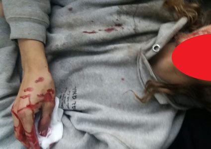 إصابة مستوطن خلال مواجهات في بلدة عوريف جنوب نابلس