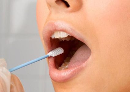 الأسنان...تأثير اضطرابات تركيبة اللعاب والعلاجات