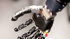 أول شخص يعيش مع ذراع روبوتية