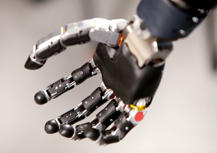 أول شخص يعيش مع ذراع روبوتية