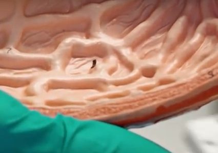 روبوت بحجم حبة الأرز ويتحرك كالـ"اليرقة"