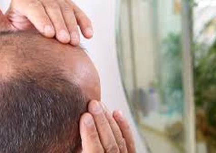 زراعة شعر بسرعة فائقة بلا علاج كيميائي