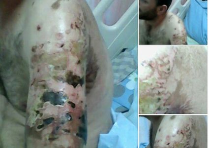 بالفيديو: زوجة الجريح جرار تروي لـ"النجاح" تفاصيل نهش كلب الاحتلال جسد زوجها..ومشفى بنابلس يتعهد بعلاجه