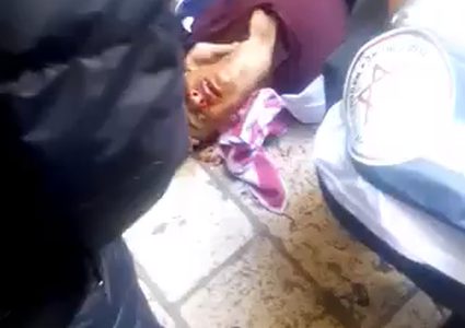 مستوطن يطعن مقدسي على باب السلسلة